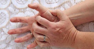 Both Hands Itching Meaning